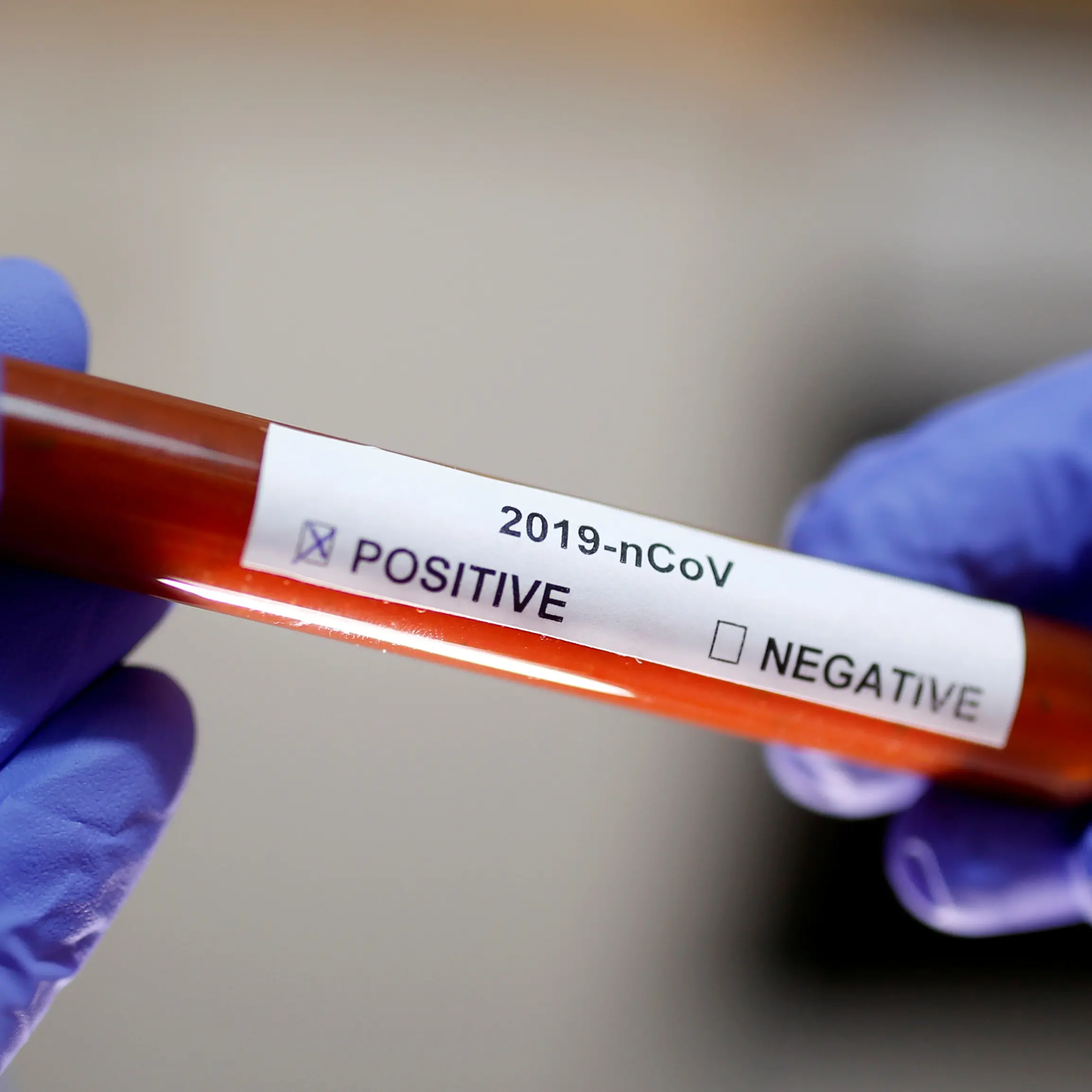 First coronavirus death reported outside of China