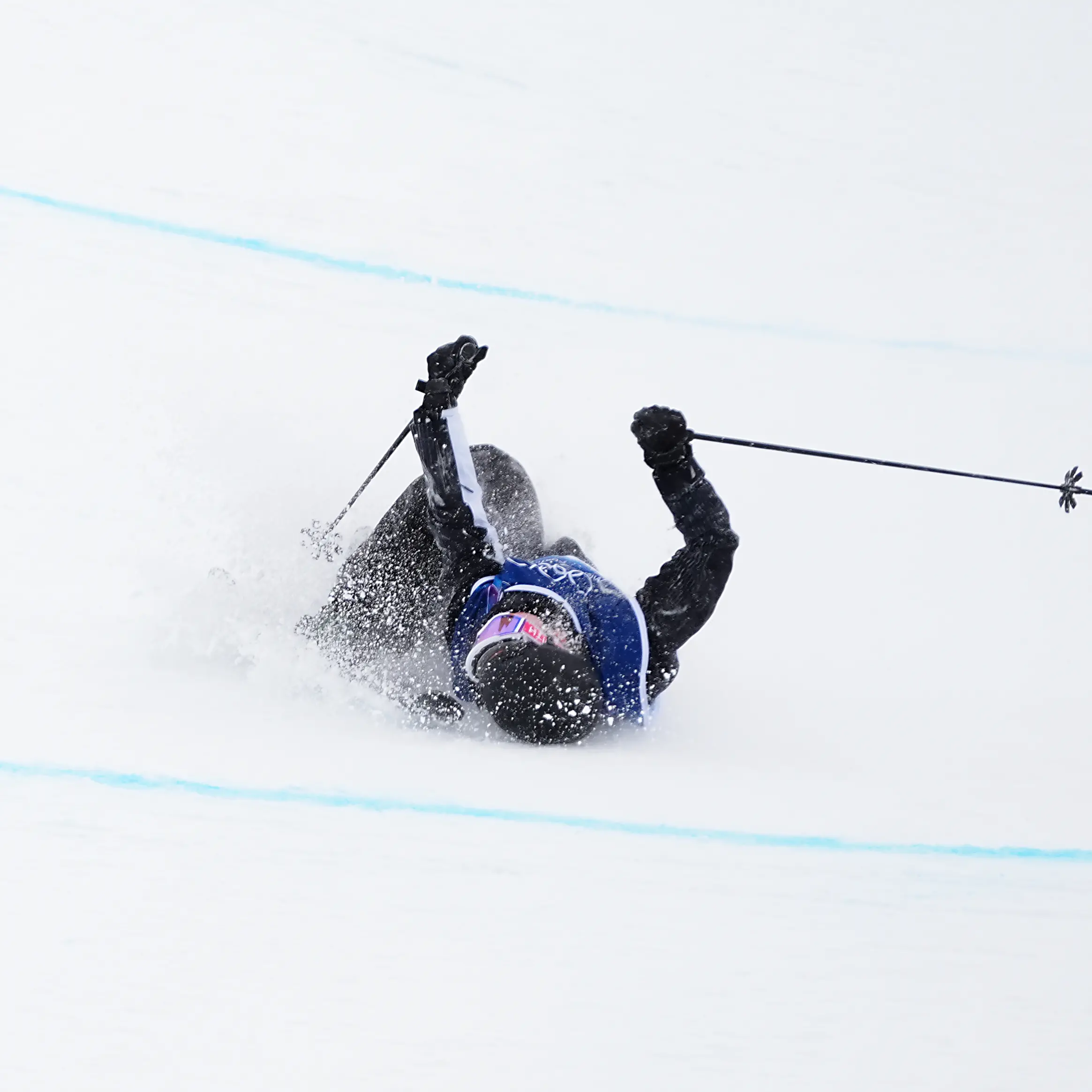 'Nothing but a scratch': Kiwi in good spirits after breaking collarbone