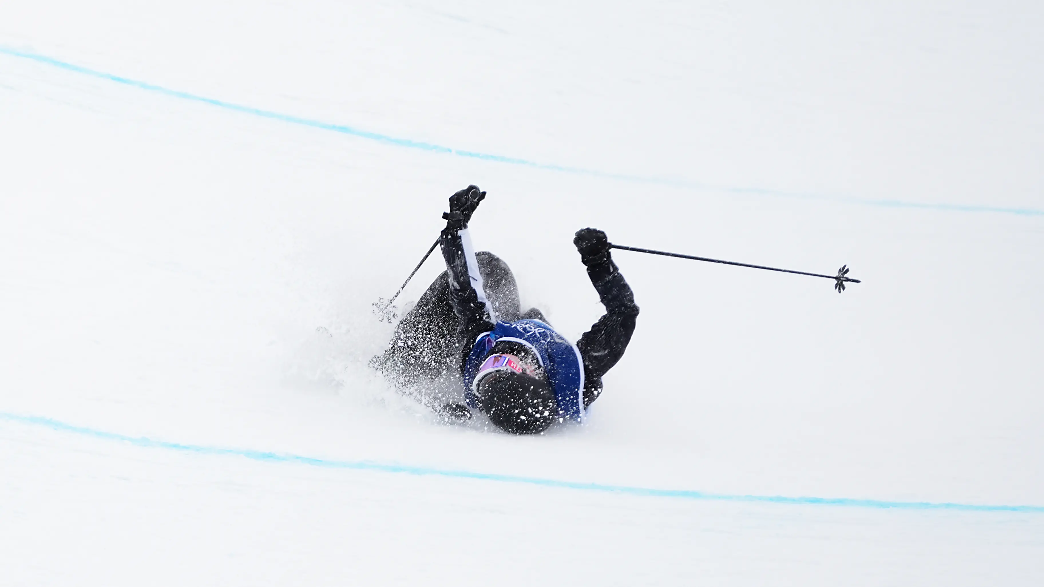 'Nothing but a scratch': Kiwi in good spirits after breaking collarbone