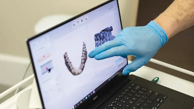 Denture South: Terrific false tooth technology that looks real