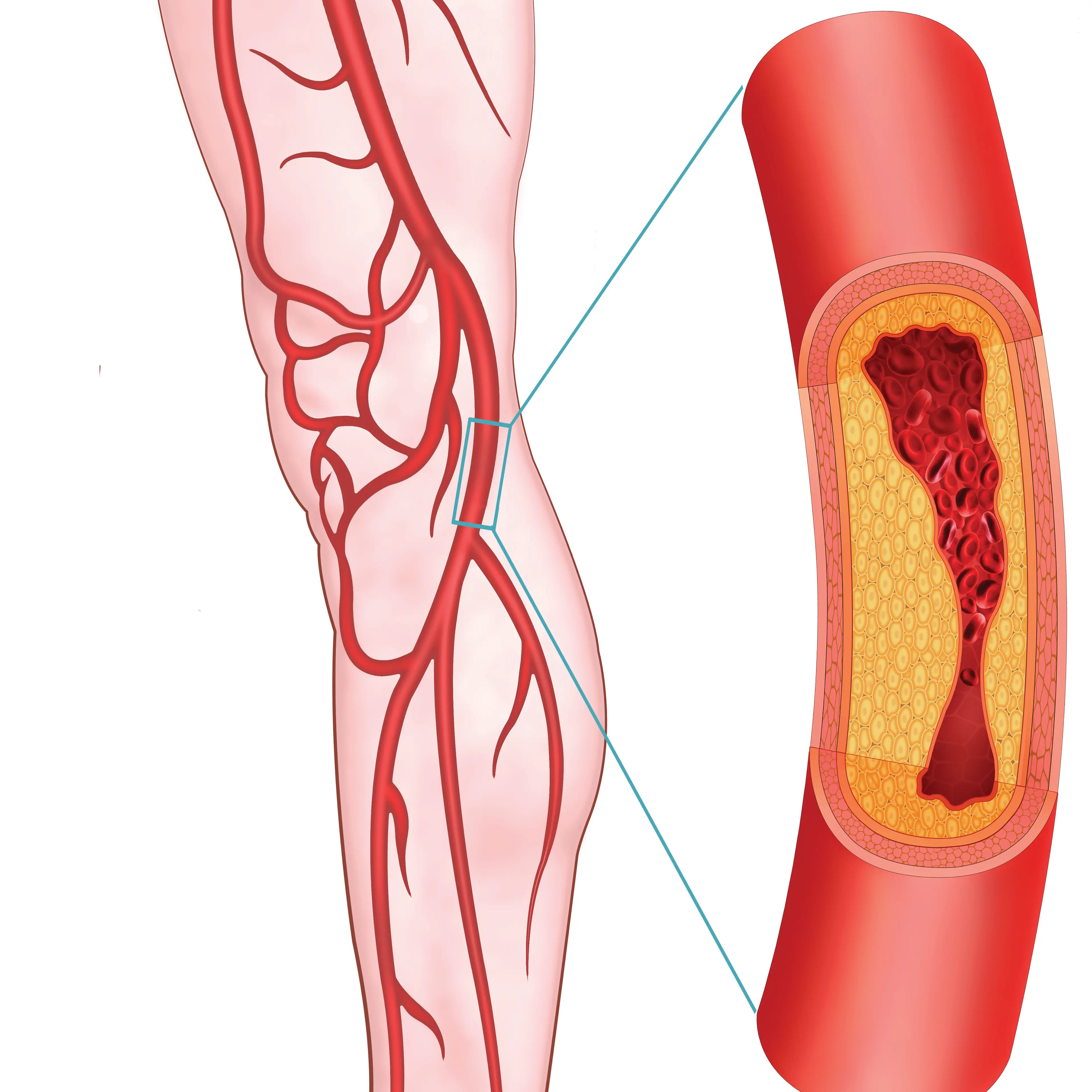 Diabetes Christchurch: Looking after your legs and feet