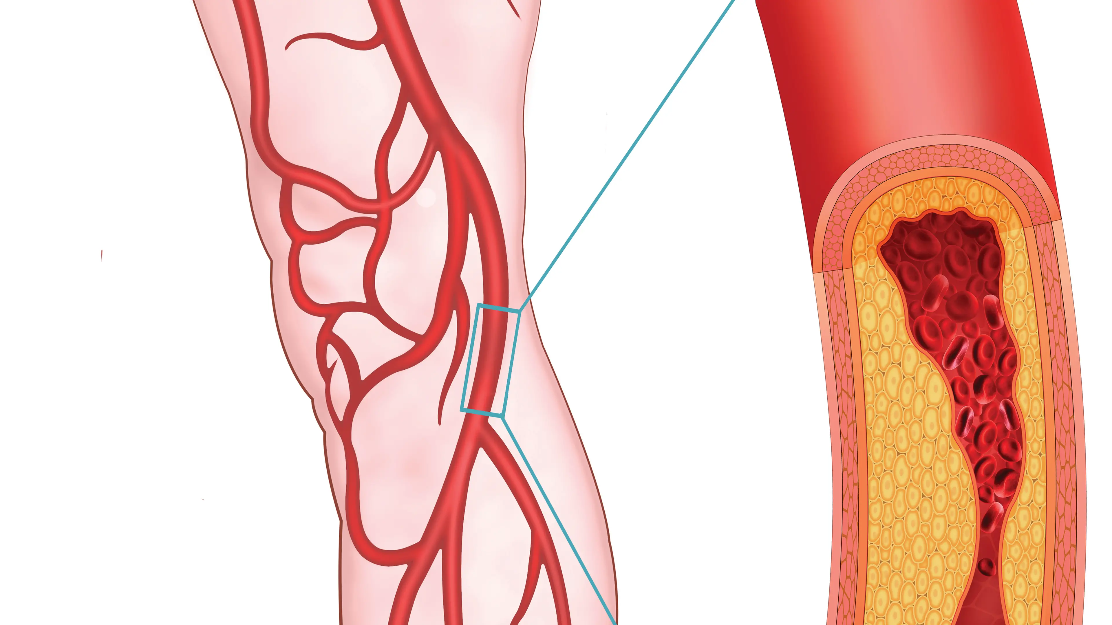 Diabetes Christchurch: Looking after your legs and feet