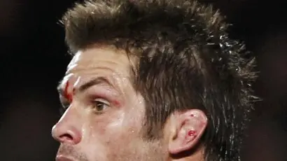 Rugby: French 'were going for the eyes' - McCaw