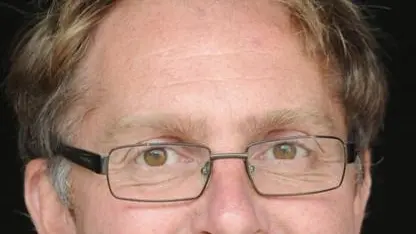Consent requirement 'frustrating'