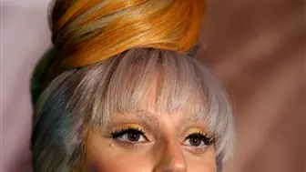 Gaga says injury 'a bump in the road'