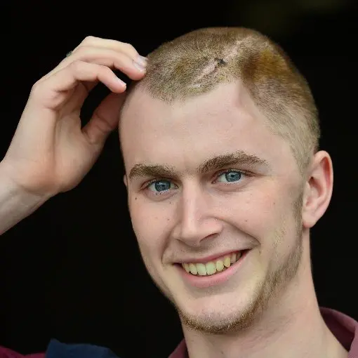 Matt's memory 'coming back' after coma