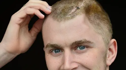 Matt's memory 'coming back' after coma