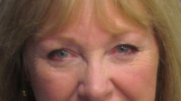 Dean says hospital food issue 'beat-up'