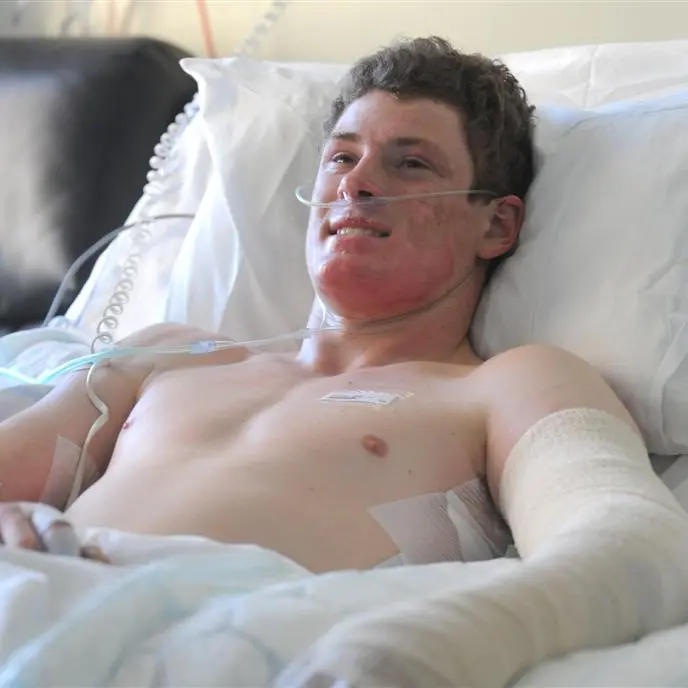 Couch leap 'stupid', burnt student says