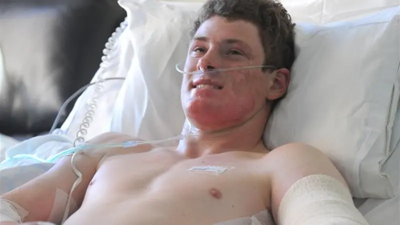 Couch leap 'stupid', burnt student says