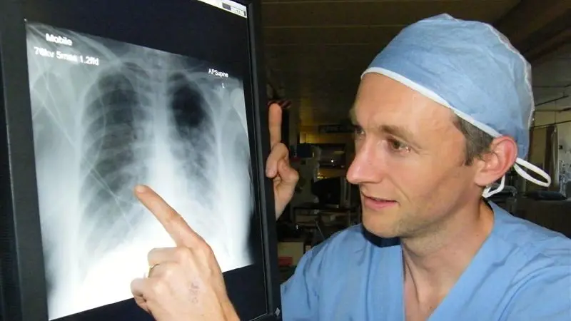 Swine flu effects now clearer