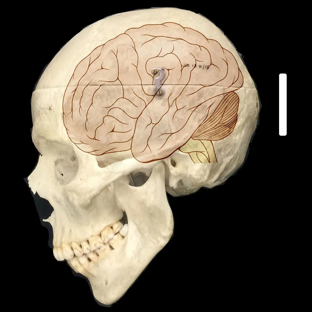 Comparisons with AI raise questions about the uniqueness of our brains