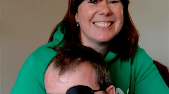 'I've traded one of my eyes for my life'