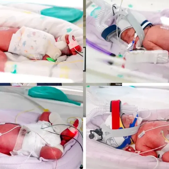 One in 15 million: Aussie mum delivers rare quadruplets