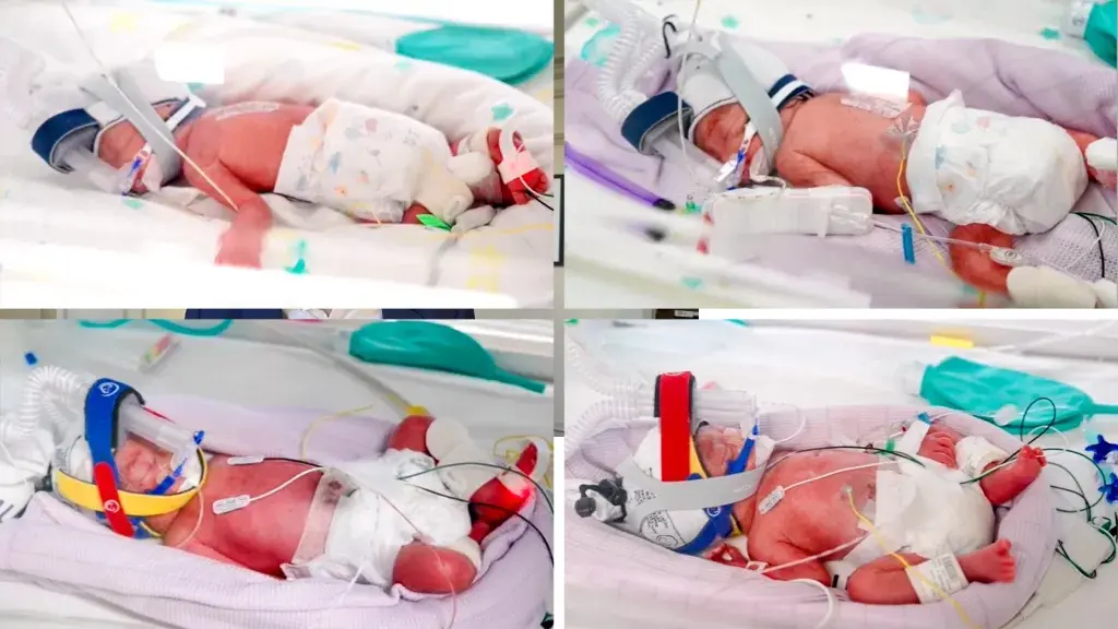 One in 15 million: Aussie mum delivers rare quadruplets