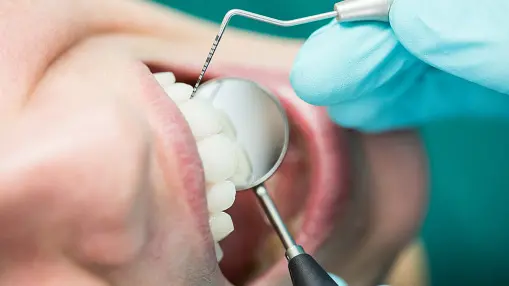 Online images of perfect teeth may erode teens’ self-confidence: new study