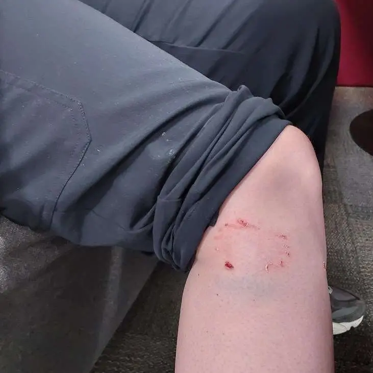 Dog attack results in menacing classification