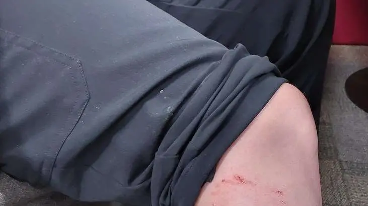 Dog attack results in menacing classification