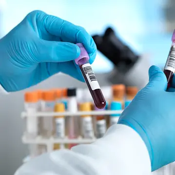 Dunedin blood test lab in disarray as senior staff leave, union says