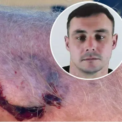 Pensioner bitten while trying to stop enraged drunk driver who just flipped car