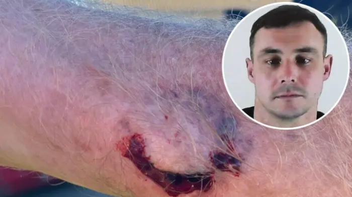Pensioner bitten while trying to stop enraged drunk driver who just flipped car