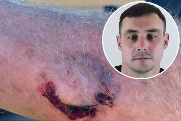 <p>Finnian Crook (inset) has been sentenced to 20 months in prison for charges including biting a bystander who tried to intervene during a road rage incident. Images: NZME</p>\\n