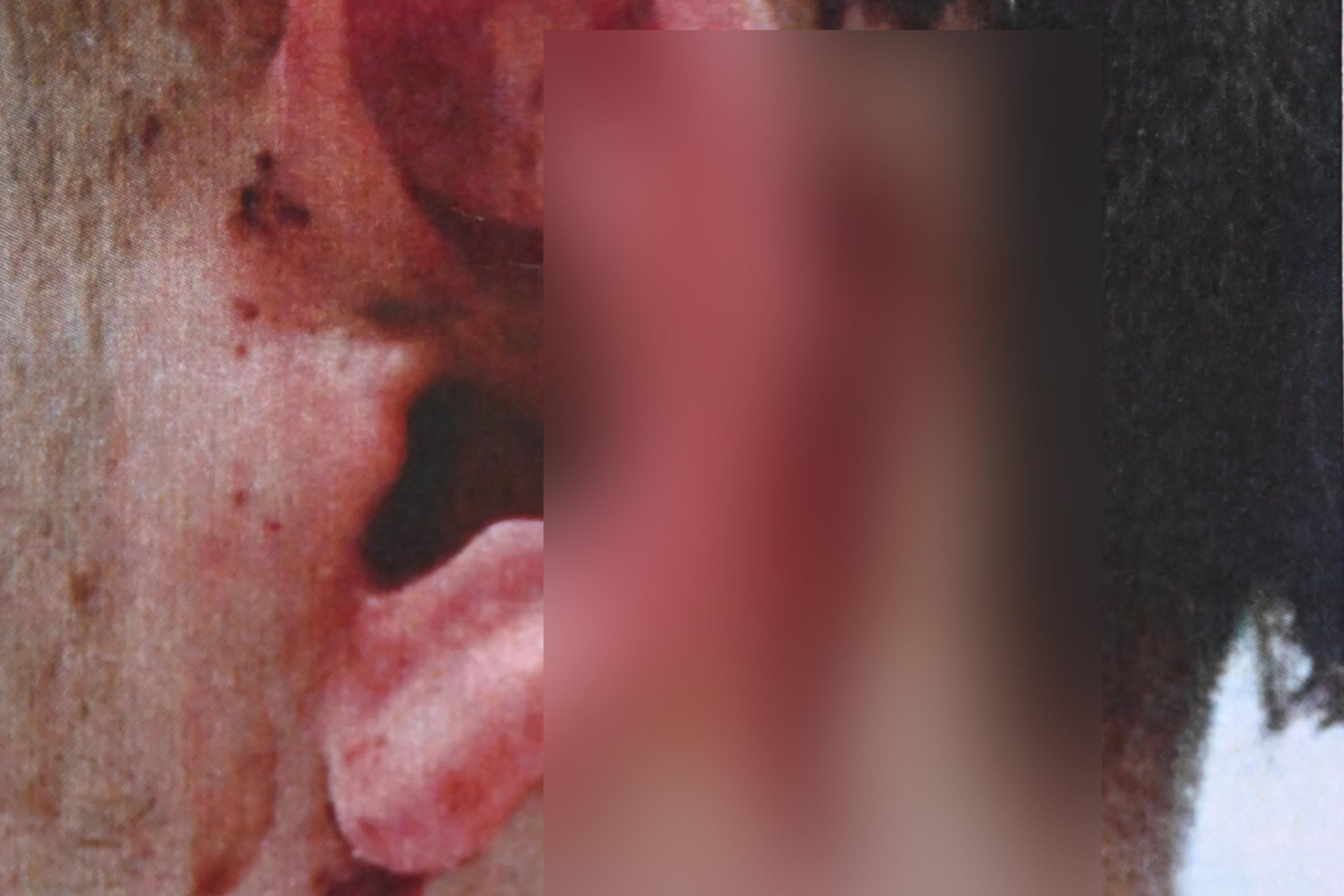 Vicious teacup attack left doctors fearing for Dunedin teen’s life