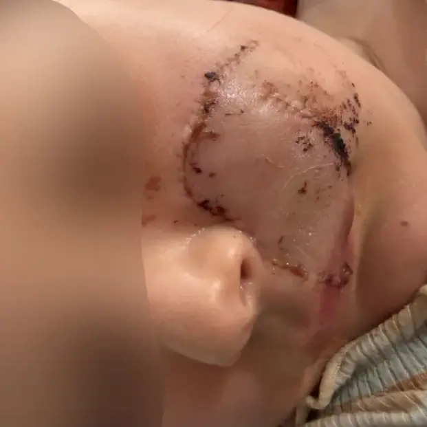 Community sentence for owner of dog that mauled girl